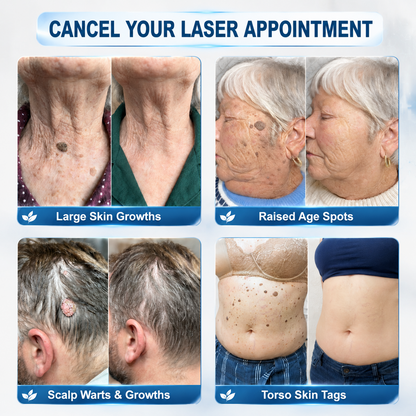 𝐇𝐈𝐒𝐊𝐈𝐍®👩‍⚕️50%